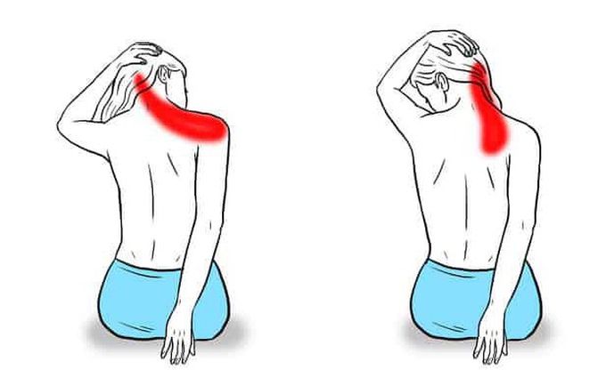 Bài tập chữa đau cổ vai gáy hiệu quả