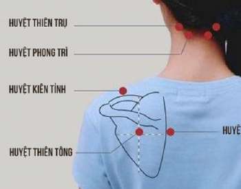 Cách xác định huyệt vùng vai gáy