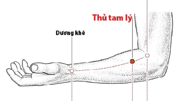 Bấm huyệt chữa đau khuỷu tay, bạn đã biết chưa?