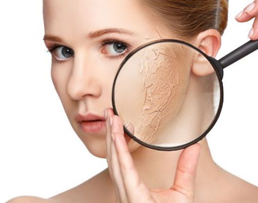 Da mặt bị khô: Nguyên nhân và cách khắc phục hiệu quả tại nhà