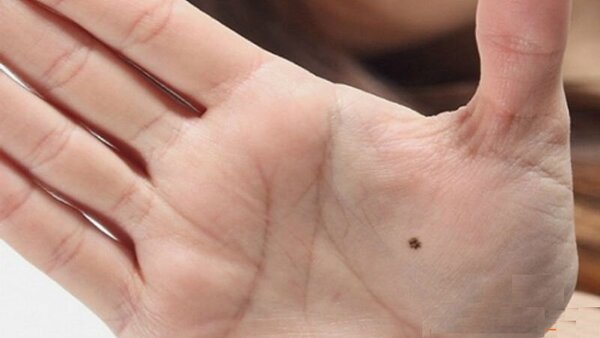 Ý nghĩa nốt loài ruồi son trong thâm tâm bàn tay trái khoáy, nên của phái nam, phái đẹp chuẩn