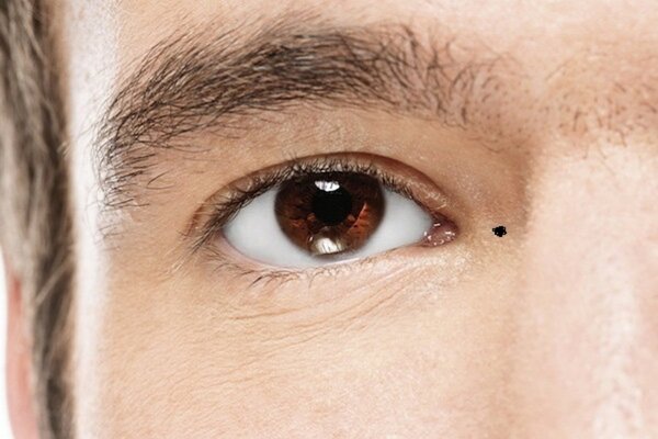 Nốt ruồi trên mí mắt trái phải, nam nữ có ý nghĩa gì? Tốt hay xấu