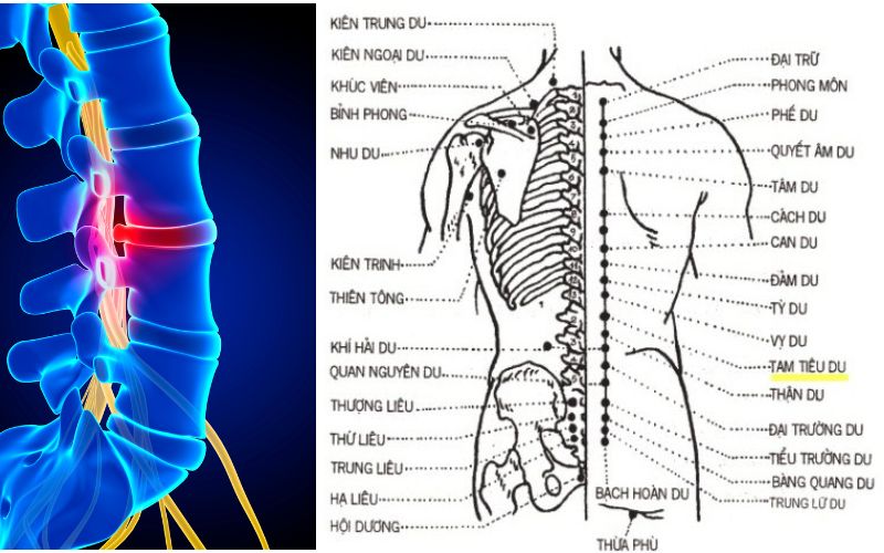 Cách massage lưng cho người thoát vị đĩa đệm